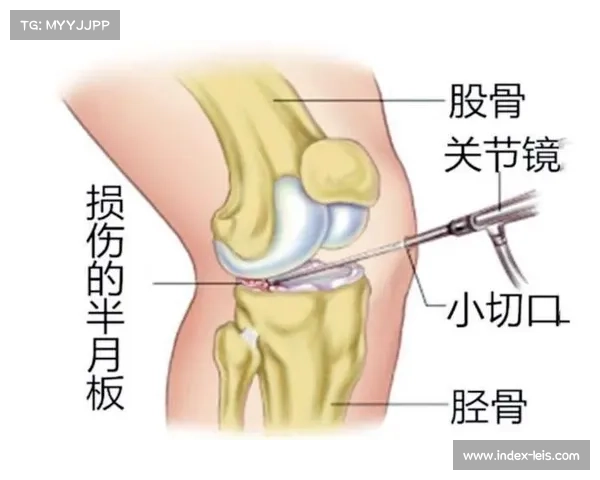 加维恢复有球训练迎关键里程碑，五个月半月板手术后复出在即